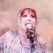 Alejandra Guzmán se sometió a una nueva cirugía