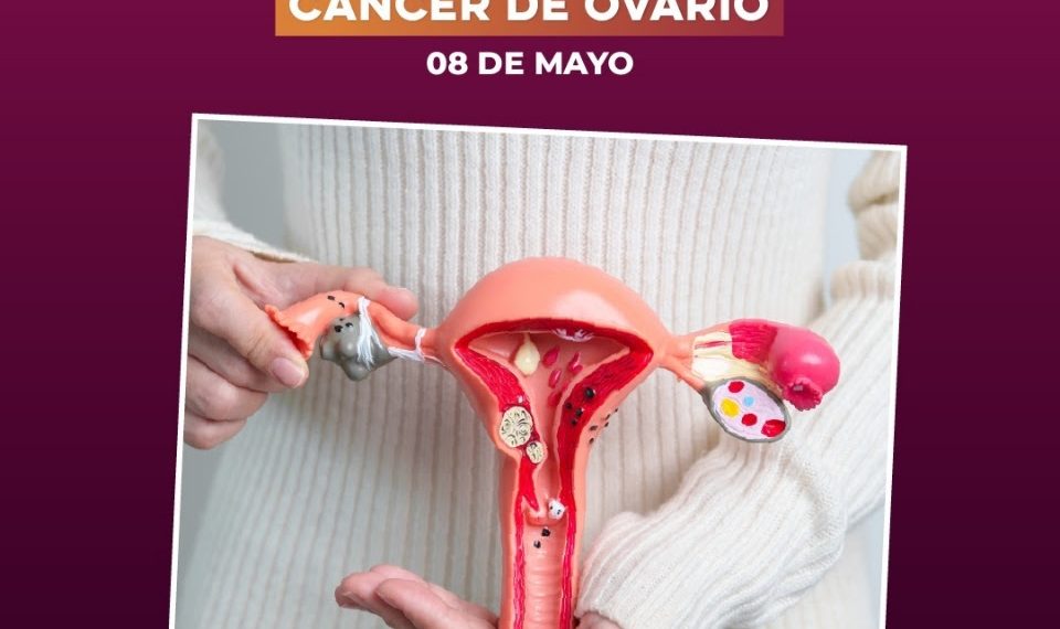 Gobierno de Sonora invita a prevenir el cáncer de ovario con chequeos médicos oportunos