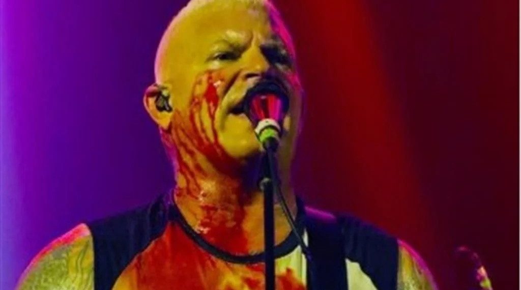 Billy Graziadei sangra tras caerse en un concierto