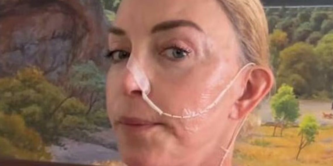 Laura Flores alarma a sus fans al aparecer usando manguera en su nariz