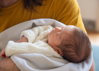 Detectan 11 casos de síndrome del hombre lobo en bebés; sus padres usaron productos anticalvicie