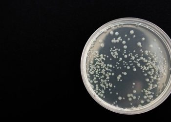 Hospitales de Edomex bajo vigilancia por bacteria Klebsiella oxytoca