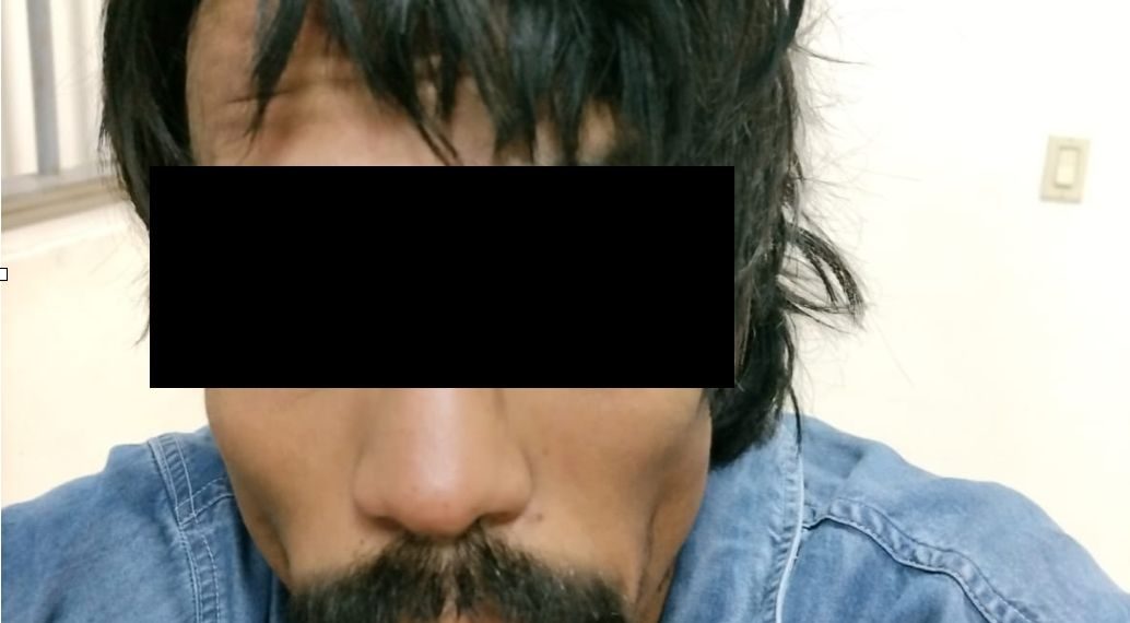 Vinculado a proceso sujeto por agresión en contra de su hermana