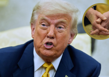 Confirman que Trump sufre insuficiencia venosa crónica