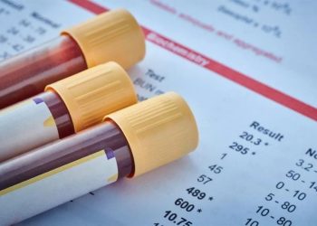 Estalla en Sedena conflicto por estudios de sangre