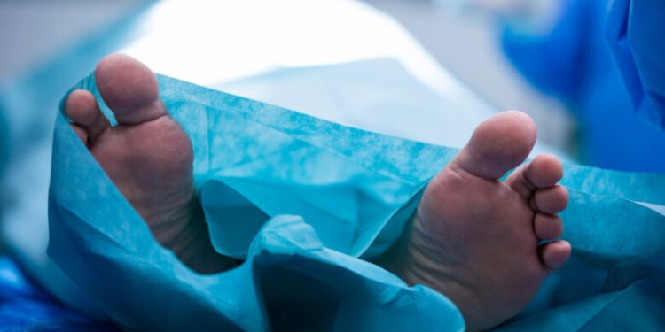 Muere adulto mayor por gusano barrenador en Oaxaca