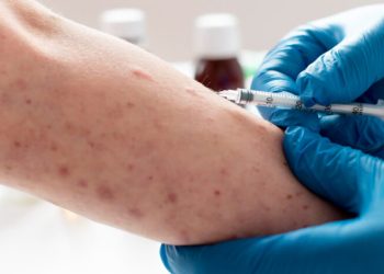 Suman 41 fallecimientos por brote de sarampión en México